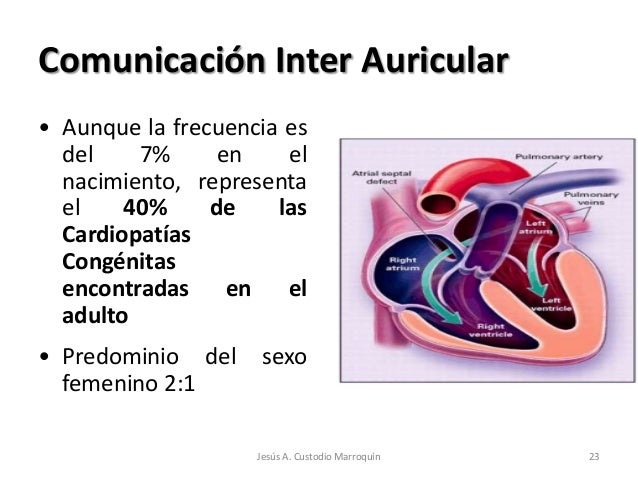 cardiopatias congenitas en pediatria